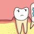 如何有效预防牙齿变松?