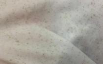白色衣服的污渍怎么去除