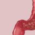 直肠息肉的症状是什么？