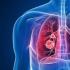 肺部CT检查需求暴增，体检机构推“阳康”体检套餐，两日销量破14万件
