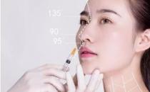 玻尿酸隆鼻会有后遗症吗（一般不会产生后遗症）