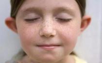 如何预防小孩形成晒斑（减少暴晒的时间找出过敏物质）